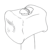 mazzuolo